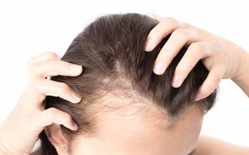 شامپوهای ضد ریزش مو