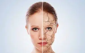 کرم آبرسان پوست | بهترین کرم های آبرسان پوست | قیمت کرم آبرسان پوست