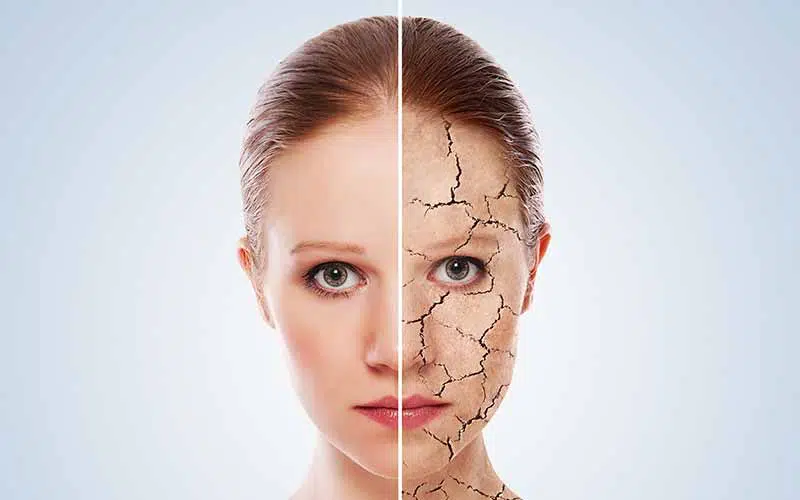 کرم آبرسان پوست | بهترین کرم های آبرسان پوست | قیمت کرم آبرسان پوست