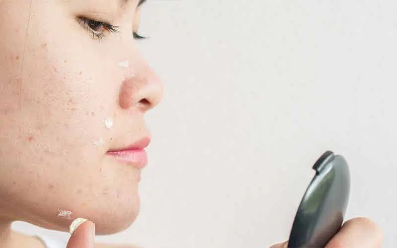 بهترین کرم های ضد جوش