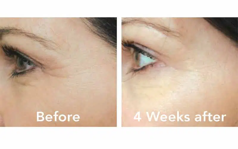 بهترین کرم لیفتینگ