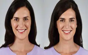 بهترین برند ژل خط