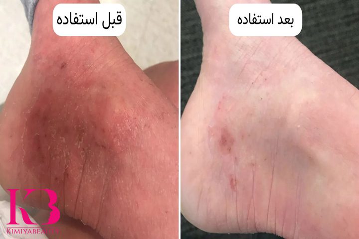 خواص کرم اوره