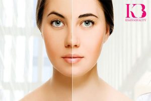 برای شفافیت پوست صورت چه کنیم؟